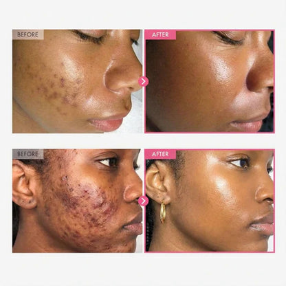 Adora Arbutin + TXA Cream