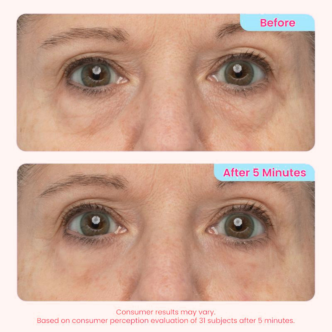 Adora Pure Instant Eye Lift