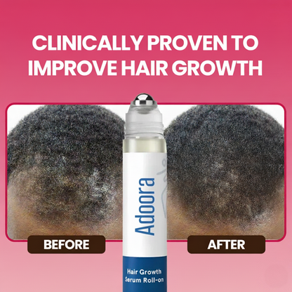 Adora Hair Growth Roll-On Serum